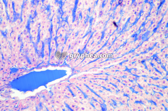 Foie injecté montrant les capillaires sanguins (sinusoïdes hépatiques) x40 - gryphea.org